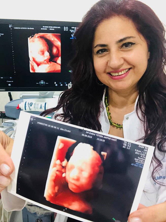 Uzm. Dr. Emine Yetgin Radyoloji Uzmanı