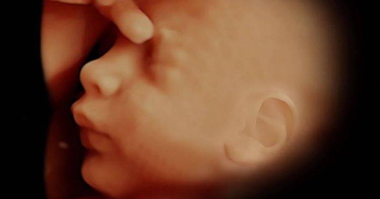 Ayrıntılı ultrason